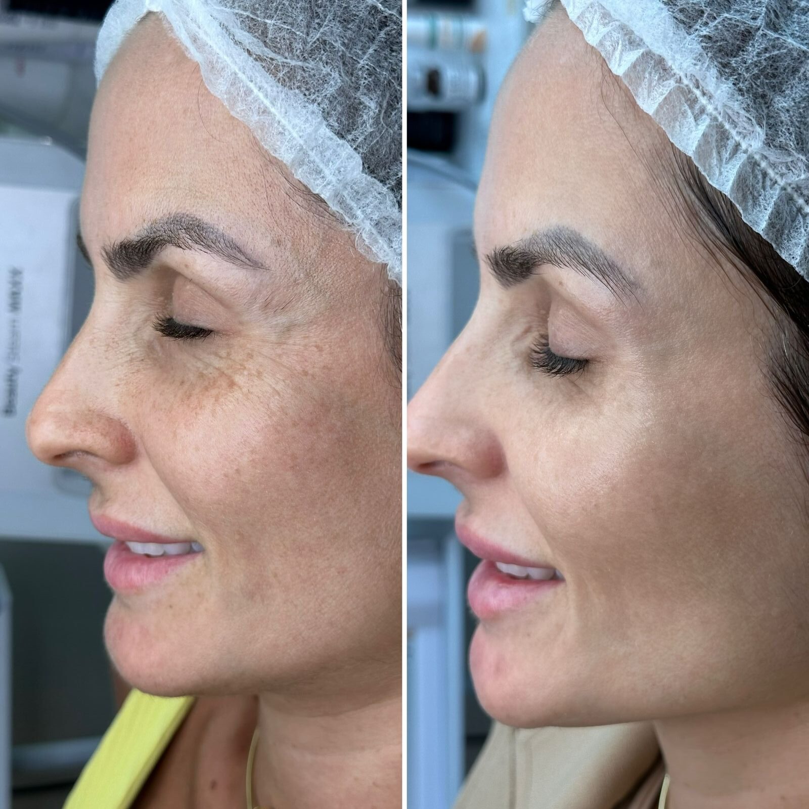 Aline Dieter Curso Skin Peach