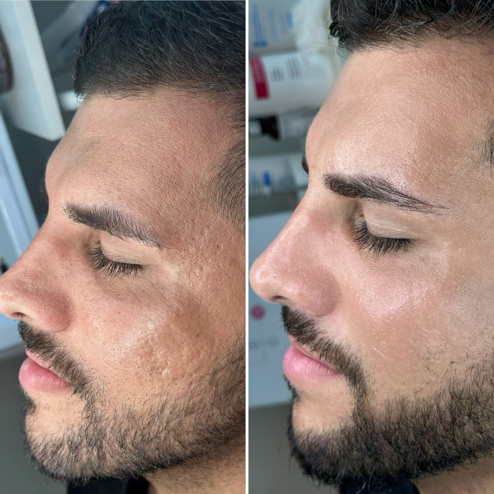 Aline Dieter Curso Skin Peach